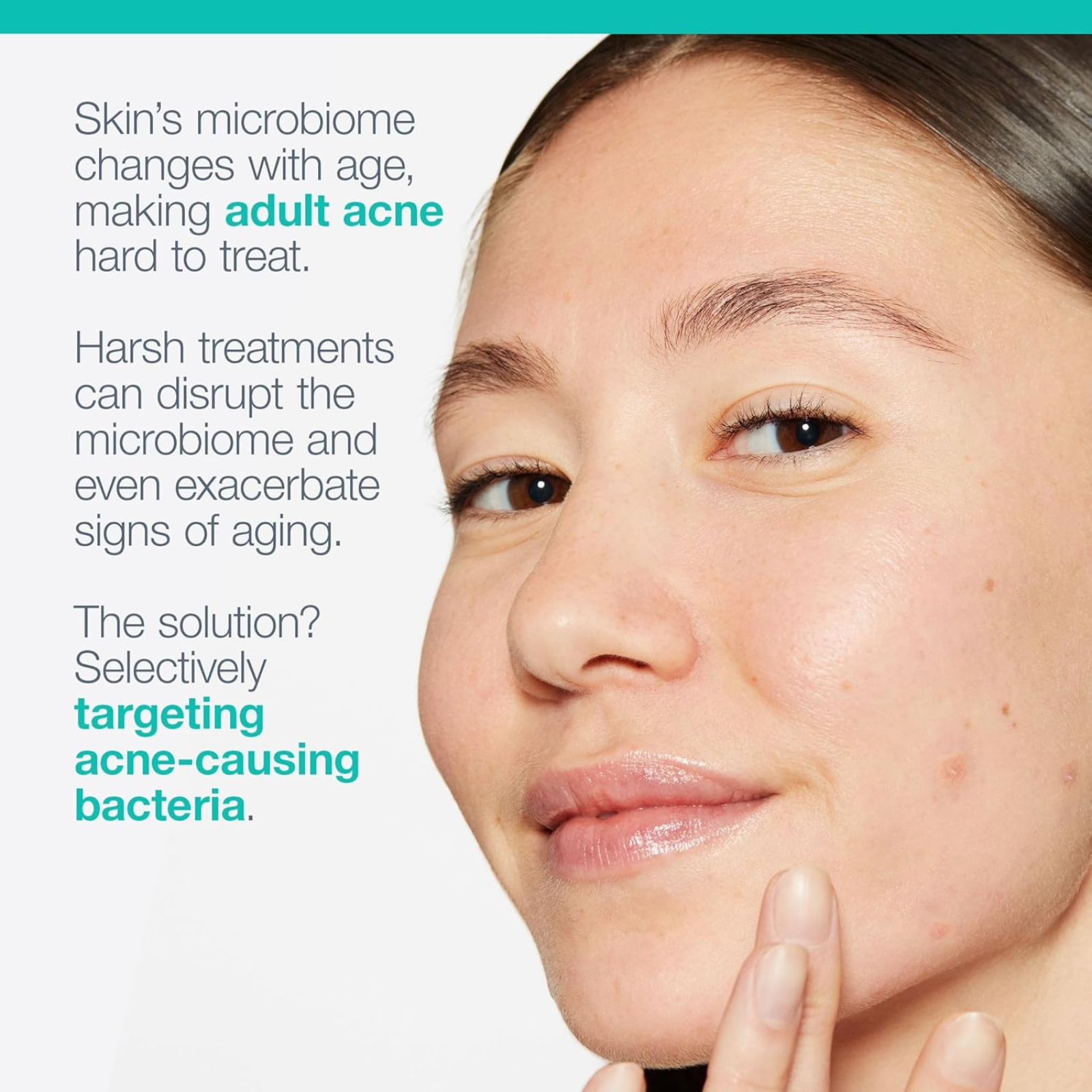 Dermalogica Acne Biotic Moisturizer (Acne-balancing moisturizer)