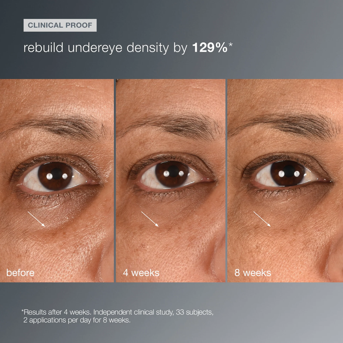 Dermalogica Smart Eye Density (Redensifying under-eye serum)