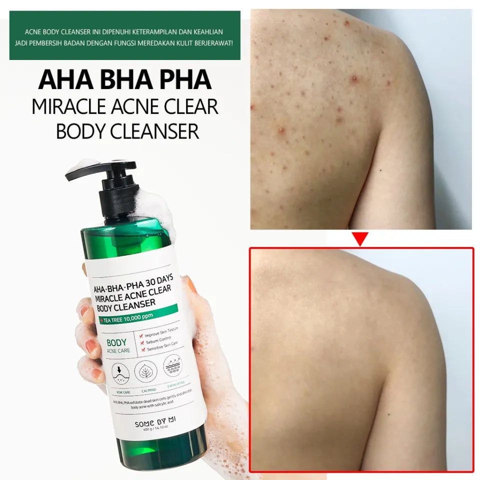 Очищающий гель для проблемной кожи тела Some By Mi (Some By Mi AHA BHA PHA 30 Days Miracle Clear Body Cleanser)