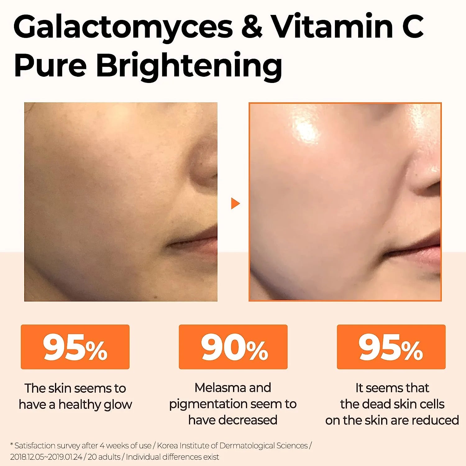 Serum with vitamin C and galactomycetes by Some By Mi (Some By Mi Galactomyces Pure Vitamin C Glow Serum)