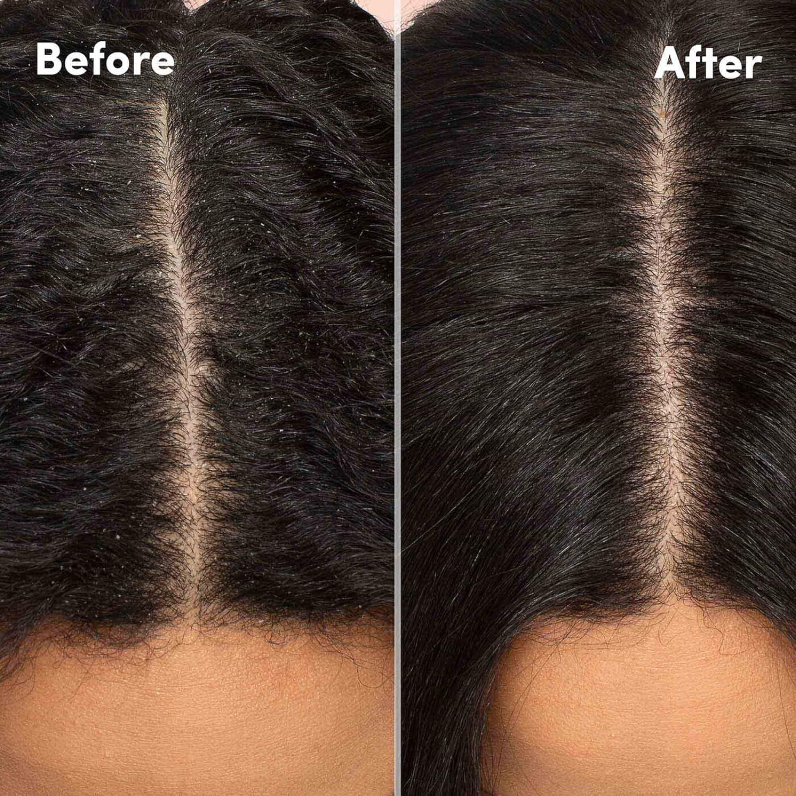 Mizani Scalp Care Scalp Calming Lotion (Leave-in scalp lotion)