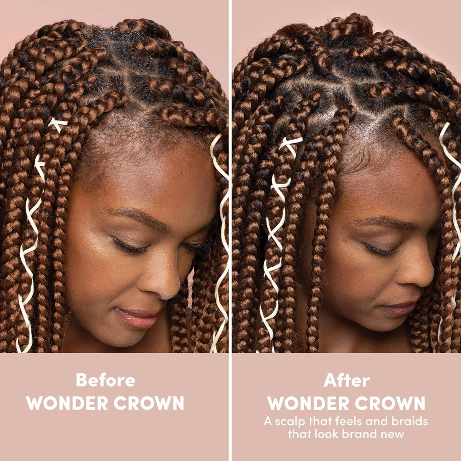 Mizani Wonder Crown Scalp Foaming Pre-Cleanse (Scalp foaming pre-cleanser)