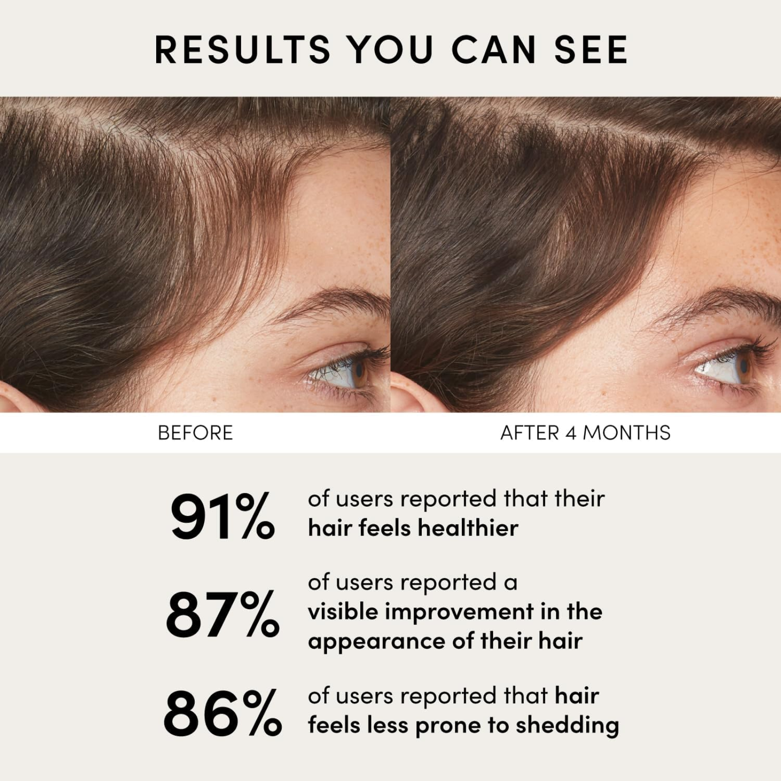 OUAI Scalp Serum (Balancing hair serum)