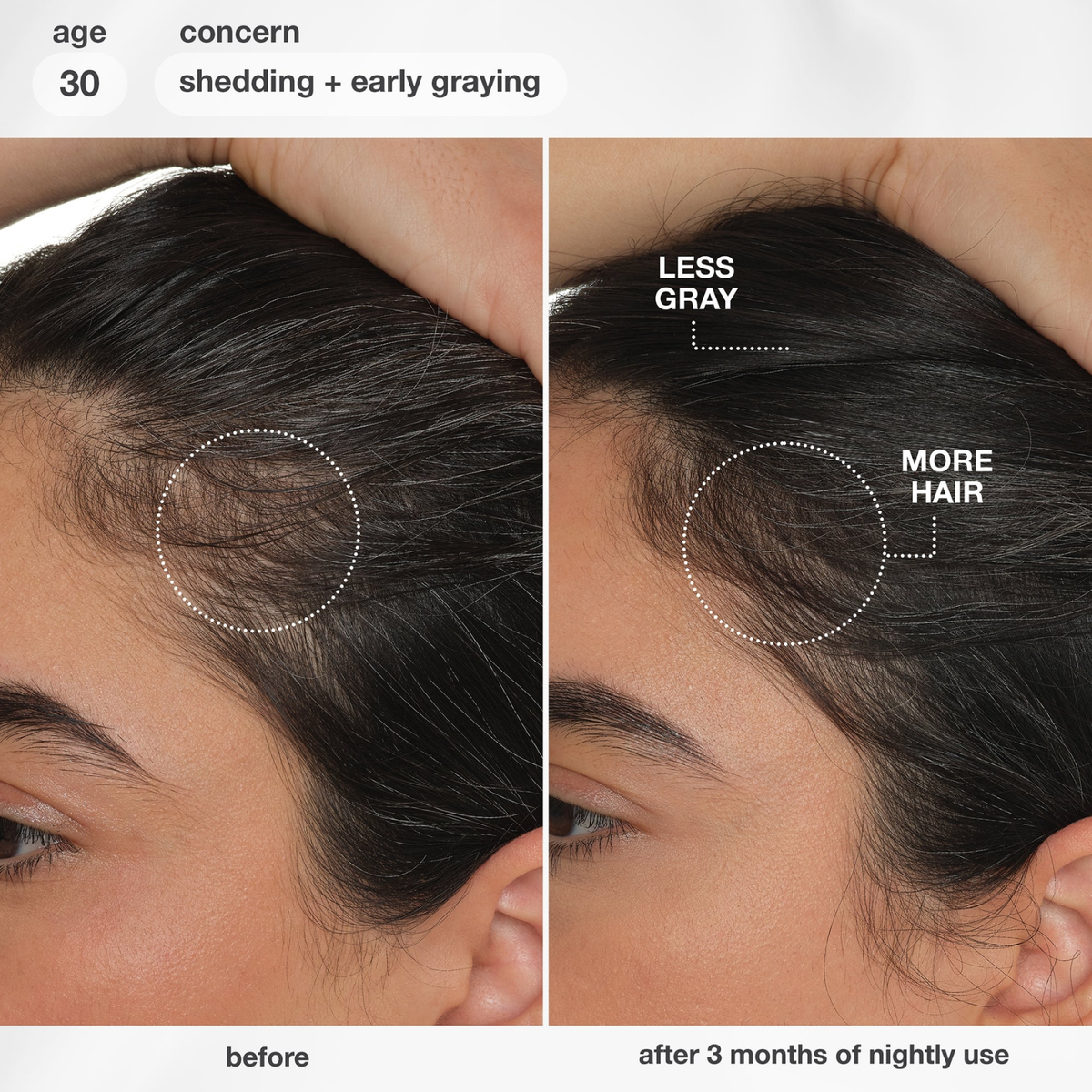 K18 Biomimetic HairScience FutureIQ Biomimetic Hair Longevity Serum (Scalp revitalizing serum)