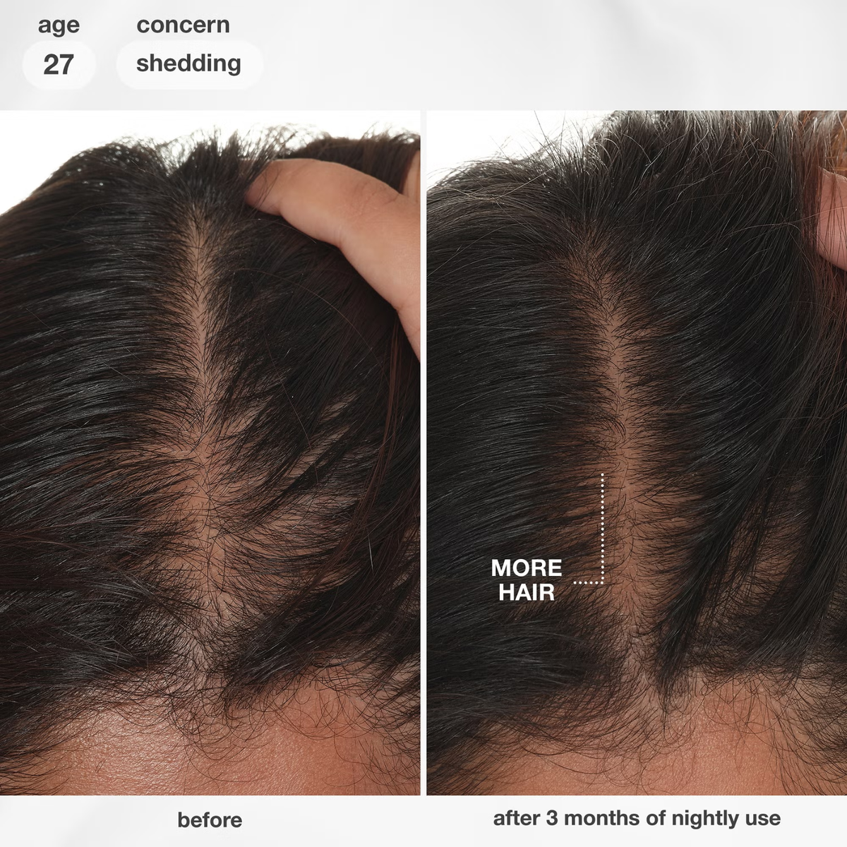 K18 Biomimetic HairScience FutureIQ Biomimetic Hair Longevity Serum (Scalp revitalizing serum)