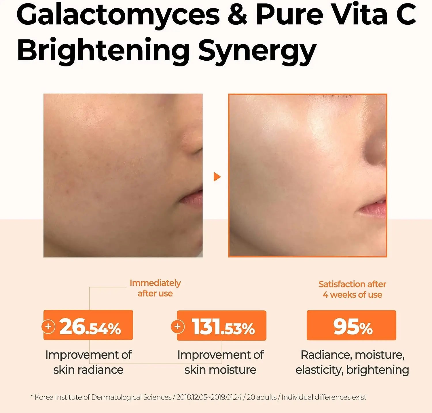 Toner with vitamin C and galactomycetes by Some By Mi (Some By Mi Galactomyces Pure Vitamin C Glow Toner)